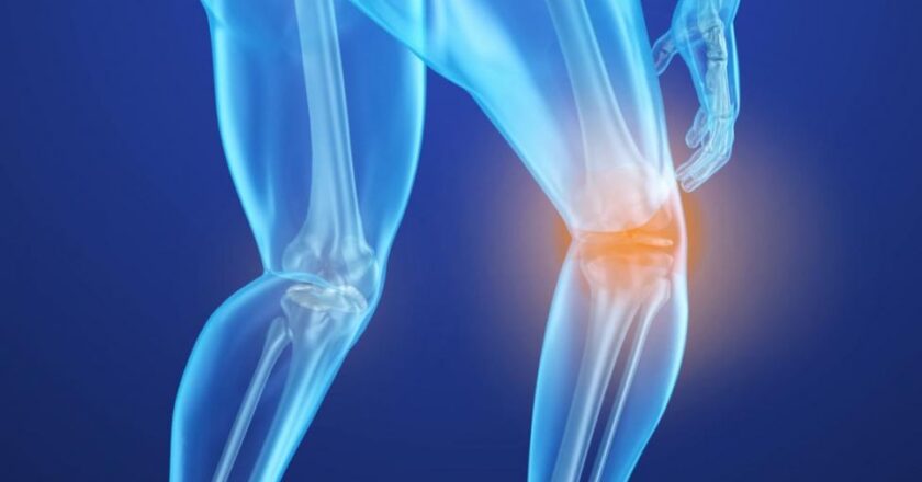 <strong>Bone Health: What You Need To Know</strong>